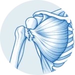 Ρήξη μείζονος θωρακικού